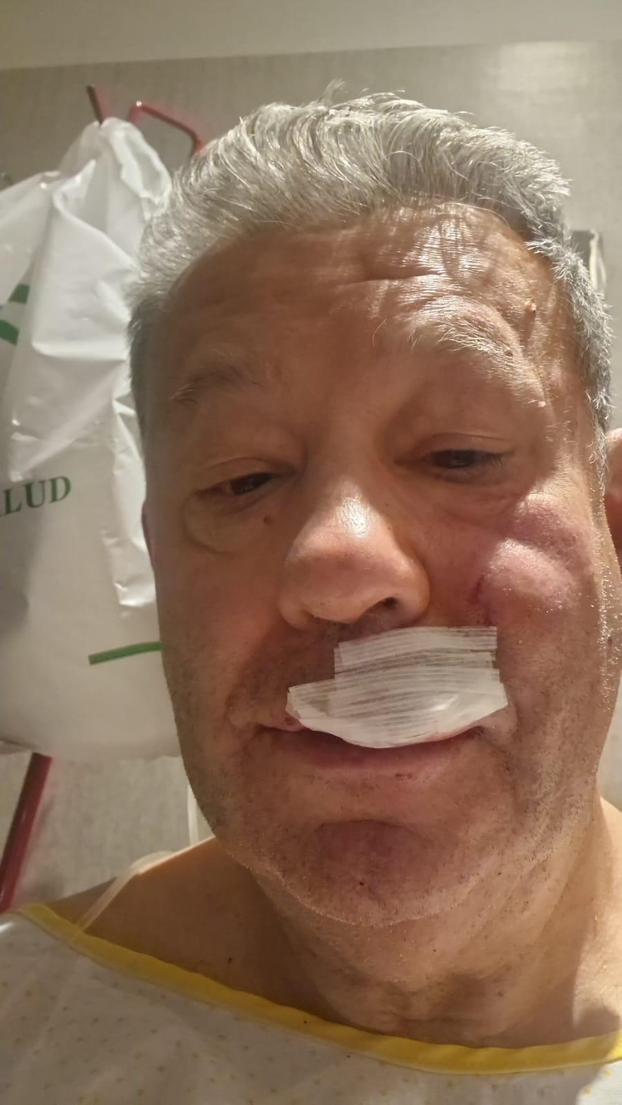 “Pasó todo muy rápido”, un encapuchado asalta y...